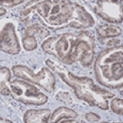 IHC staining of STUB1 protein