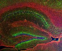 Aging Labs image