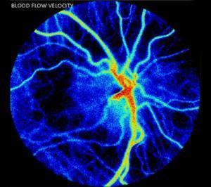 Eye blood flow image