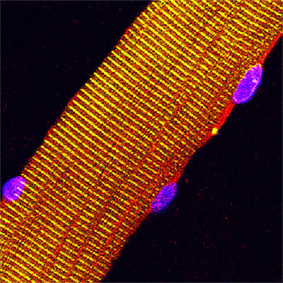 Mouse muscle fiber