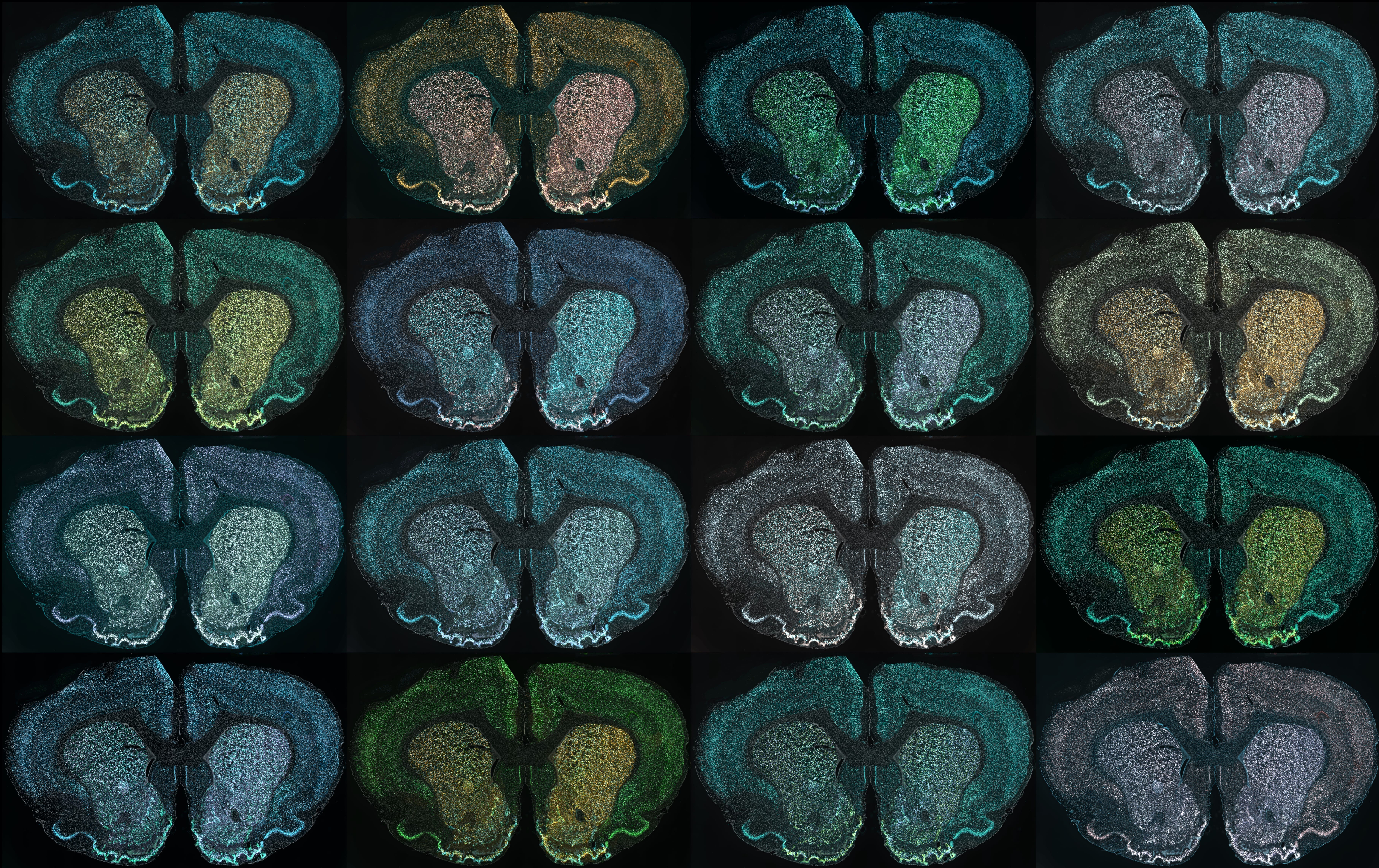 Rows of pseudocolored rat brain slices arranged in a collage