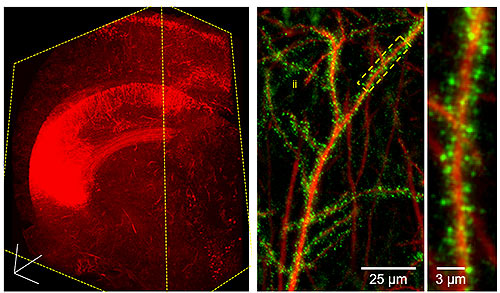 Hippocampus (left) and individual neurons within the brain of a mouse that had been electroporated (in utero) with cDNAs encoding the fluorescent protein tdTomato (red) as well as an adhesion molecule called LRRTM2 that has been tagged with GFP (green). LRRTM2 is concentrated within dendritic spines (middle and right) and there regulates synapse nanostructure. (from labs of Poulopoulos & Blanpied)