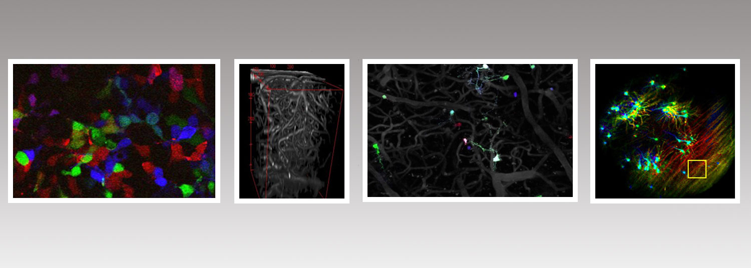 Four slides of objects in microscope